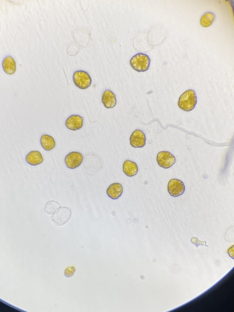 dinoflagellates in November 2023 by Efren Chen. 400x. From freshwater ...