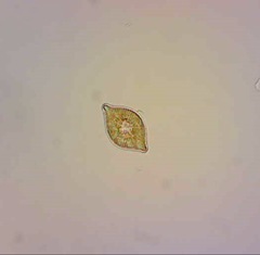 Rhaphoneis amphiceros