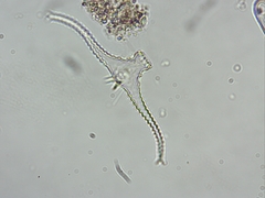 Staurastrum leptocladum