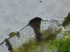 Intralichen baccisporus