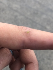 Aphididae