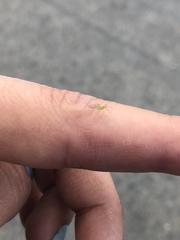 Aphididae