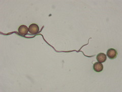 Paradiachea caespitosa