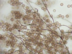 Stemonitopsis reticulata