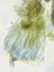 Dothideomycetes