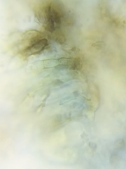 Dothideomycetes