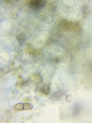 Dothideomycetes