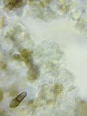 Dothideomycetes