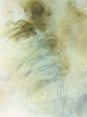 Dothideomycetes