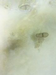 Dothideomycetes