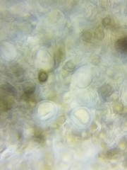 Dothideomycetes
