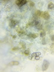 Dothideomycetes