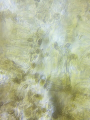 Dothideomycetes