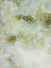 Dothideomycetes