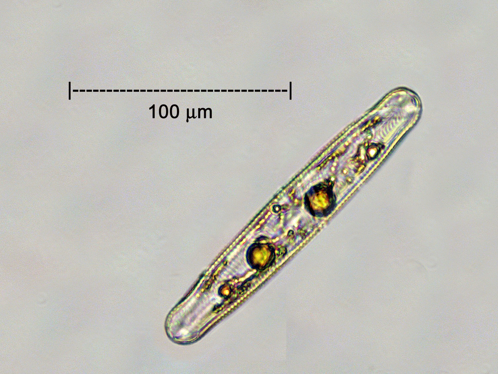 Pinnularia acrosphaeria