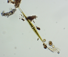 Closterium kuetzingii