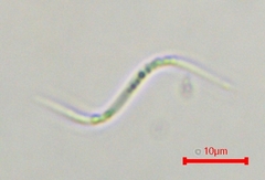 Monoraphidium contortum
