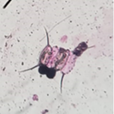 Scenedesmus