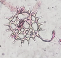 Hydrodictyaceae