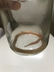 Ascaris lumbricoides