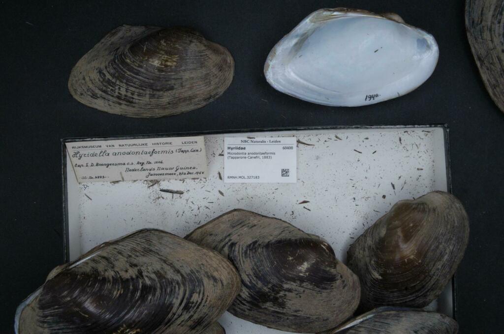 Microdontia