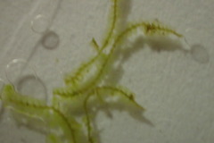 Cheilolejeunea clausa