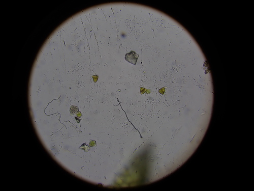 Image of Tritomaria exsectiformis by (c) Chris Fluit, some rights reserved (CC BY)