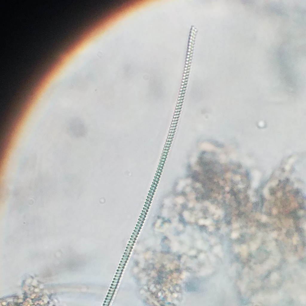 cyanobacteria from Olympia Heights, FL, USA on December 2, 2023 at 07: ...