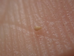 Johnstonella micromeres