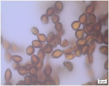 Trentepohlia rigidula