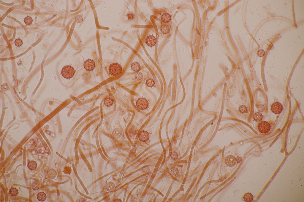 Rhizophlyctis
