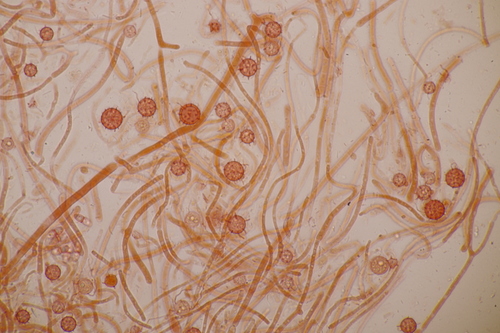 Representative image of Rhizophlyctidales