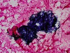 Bacillus thuringiensis