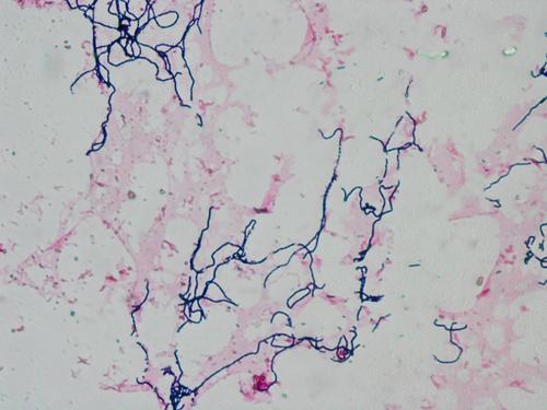 streptococci gram stain