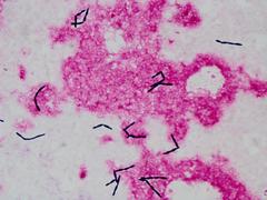 Magnusiomyces capitatus