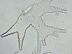 Micrasterias mahabuleshwarensis