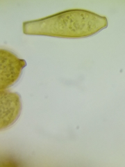 Botryobasidium simile