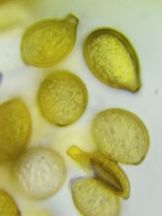 Botryobasidium simile