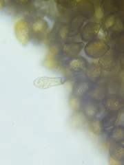 Botryobasidium simile