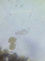 Botryobasidium simile