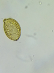 Botryobasidium simile