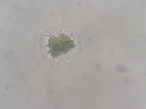Staurastrum forficulatum