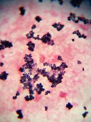 Staphylococcus aureus
