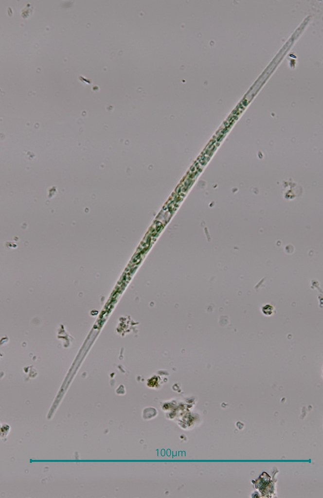 Closterium from Wayne County, NC, USA on December 17, 2023 at 02:43 PM ...