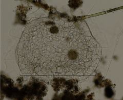 Actinosphaerium