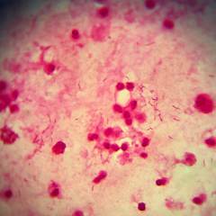Pseudomonas