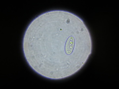 Xylographa parallela