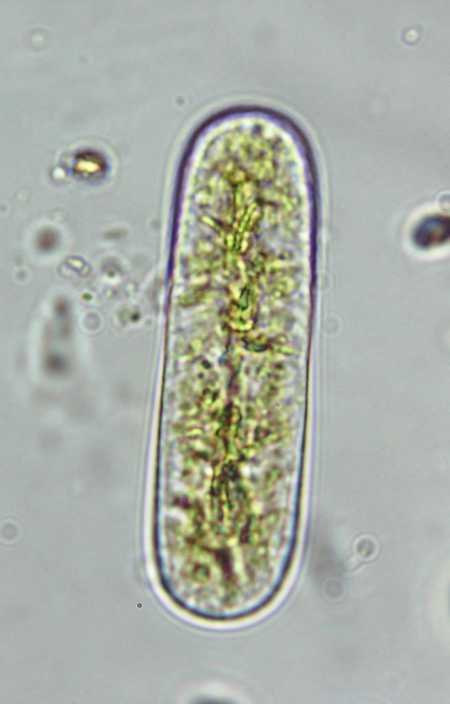 Cylindrocystis