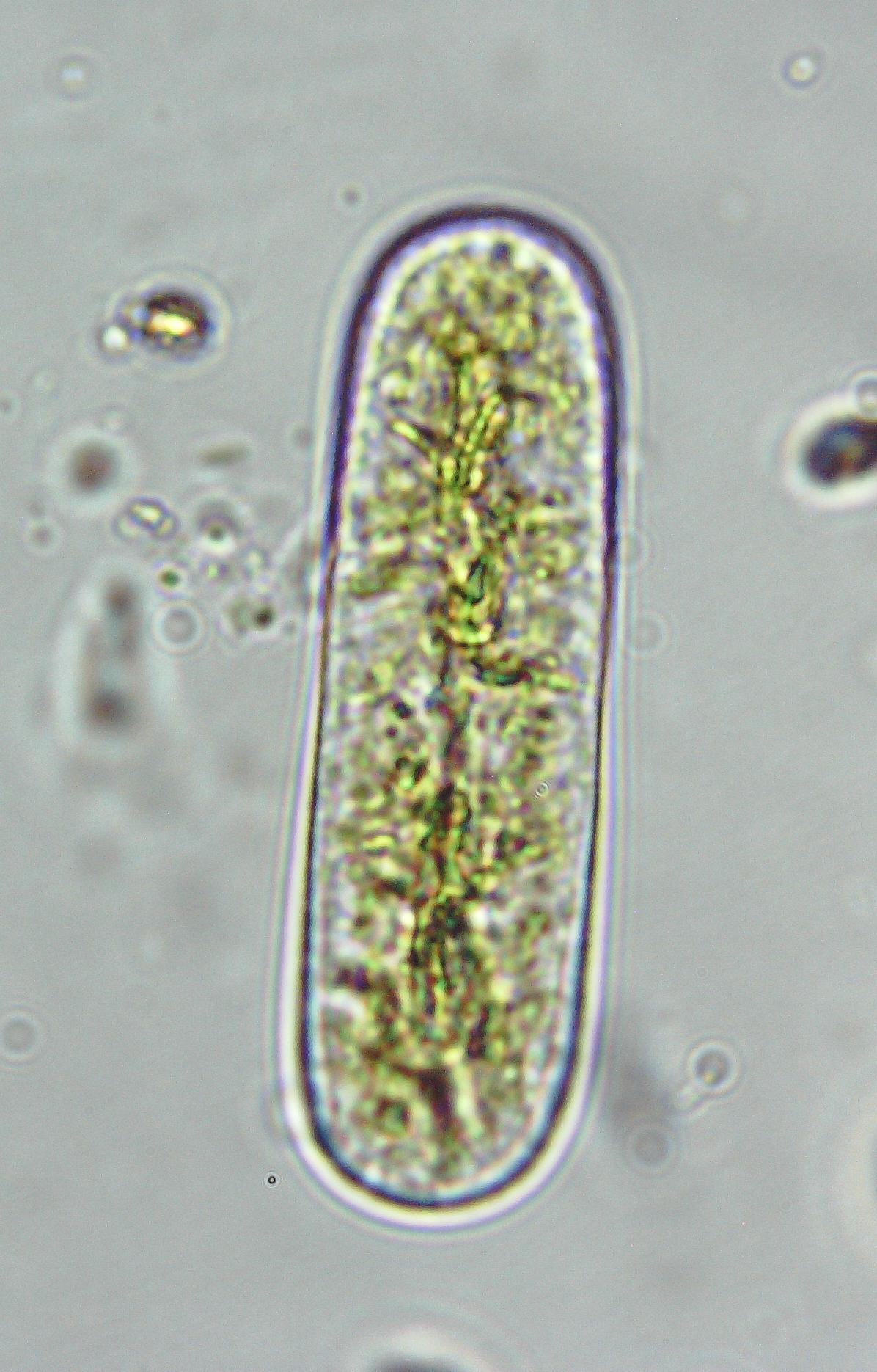 Cylindrocystis