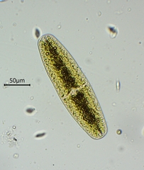 Netrium digitus